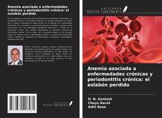 Buchcover von Anemia asociada a enfermedades crónicas y periodontitis crónica: el eslabón perdido