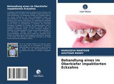 Capa do livro de Behandlung eines im Oberkiefer impaktierten Eckzahns 
