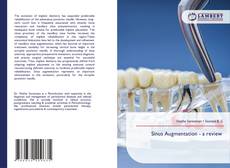 Bookcover of Sinus Augmentation - a review
