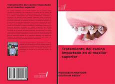 Portada del libro de Tratamiento del canino impactado en el maxilar superior