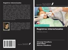 Bookcover of Registros interoclusales
