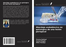 Abordaje endodóncico no quirúrgico de una lesión periapical的封面