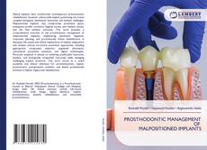 Capa do livro de PROSTHODONTIC MANAGEMENT OF MALPOSITIONED IMPLANTS 