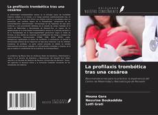 Bookcover of La profilaxis trombótica tras una cesárea