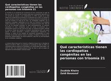 Qué características tienen las cardiopatías congénitas en las personas con trisomía 21 kitap kapağı