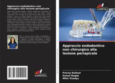 Capa do livro de Approccio endodontico non chirurgico alla lesione periapicale 