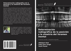 Bookcover of Determinación radiográfica de la posición y la simetría del foramen mental