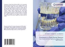 Connectors in Fixed Partial Denture的封面