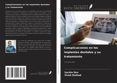 Обложка Complicaciones en los implantes dentales y su tratamiento