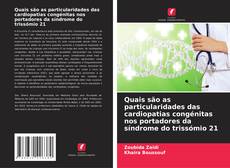 Copertina di Quais são as particularidades das cardiopatias congénitas nos portadores da síndrome do trissómio 21
