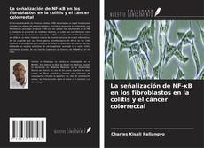 La señalización de NF-κB en los fibroblastos en la colitis y el cáncer colorrectal的封面