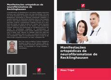 Copertina di Manifestações ortopédicas da neurofibromatose de Recklinghausen