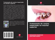 Buchcover von Tratamento do canino impactado no maxilar superior