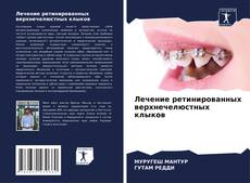 Лечение ретинированных верхнечелюстных клыков的封面