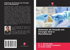 Buchcover von Sistemas de fixação em Cirurgia Oral e Maxilofacial