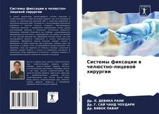 Buchcover von Системы фиксации в челюстно-лицевой хирургии