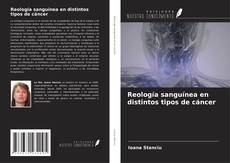 Couverture de Reología sanguínea en distintos tipos de cáncer