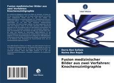 Couverture de Fusion medizinischer Bilder aus zwei Verfahren: Knochenszintigraphie