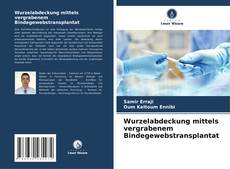 Couverture de Wurzelabdeckung mittels vergrabenem Bindegewebstransplantat