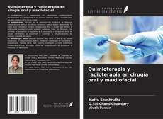 Quimioterapia y radioterapia en cirugía oral y maxilofacial的封面