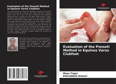 Evaluation of the Ponseti Method in Equinus Varus Clubfoot的封面
