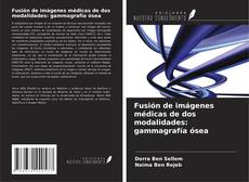 Обложка Fusión de imágenes médicas de dos modalidades: gammagrafía ósea