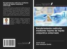 Recubrimiento radicular mediante injerto de tejido conjuntivo enterrado kitap kapağı