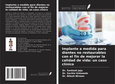 Обложка Implante a medida para dientes no restaurables con el fin de mejorar la calidad de vida: un caso clínico