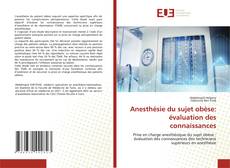 Bookcover of Anesthésie du sujet obèse: évaluation des connaissances