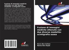Copertina di Fusione di immagini mediche ottenute con due diverse modalità: scintigrafia ossea