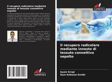 Copertina di Il recupero radicolare mediante innesto di tessuto connettivo sepolto