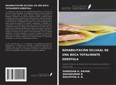 Borítókép a  REHABILITACIÓN OCLUSAL DE UNA BOCA TOTALMENTE EDÉNTULA - hoz