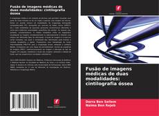 Copertina di Fusão de imagens médicas de duas modalidades: cintilografia óssea