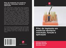 Pilar de implante em medicina dentária: conceção, função e aplicação kitap kapağı