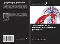 Bookcover of Tratamiento de los traumatismos arteriales periféricos