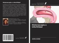 Bookcover of Histeroscopia e infertilidad