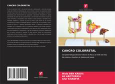 CANCRO COLORRETAL kitap kapağı