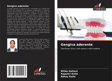 Bookcover of Gengiva aderente