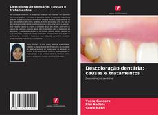 Descoloração dentária: causas e tratamentos的封面