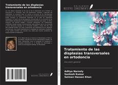 Borítókép a  Tratamiento de las displasias transversales en ortodoncia - hoz