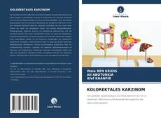 Portada del libro de KOLOREKTALES KARZINOM