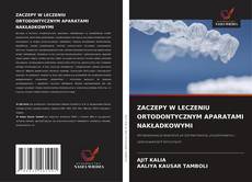 Portada del libro de ZACZEPY W LECZENIU ORTODONTYCZNYM APARATAMI NAKŁADKOWYMI