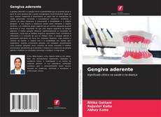 Обложка Gengiva aderente