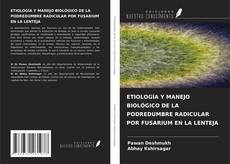 Bookcover of ETIOLOGÍA Y MANEJO BIOLÓGICO DE LA PODREDUMBRE RADICULAR POR FUSARIUM EN LA LENTEJA