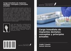 Bookcover of Carga inmediata de implantes dentales: conceptos y principios actuales