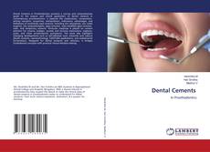 Bookcover of Dental Cements