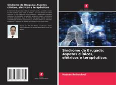 Síndrome de Brugada: Aspetos clínicos, elétricos e terapêuticos kitap kapağı