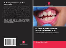 Couverture de O dente permanente imaturo necrosado