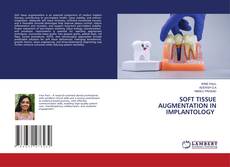 Capa do livro de SOFT TISSUE AUGMENTATION IN IMPLANTOLOGY 
