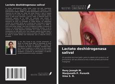 Bookcover of Lactato deshidrogenasa salival